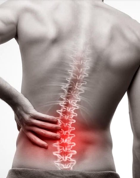 back Pain